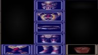 Profko Dragon Set